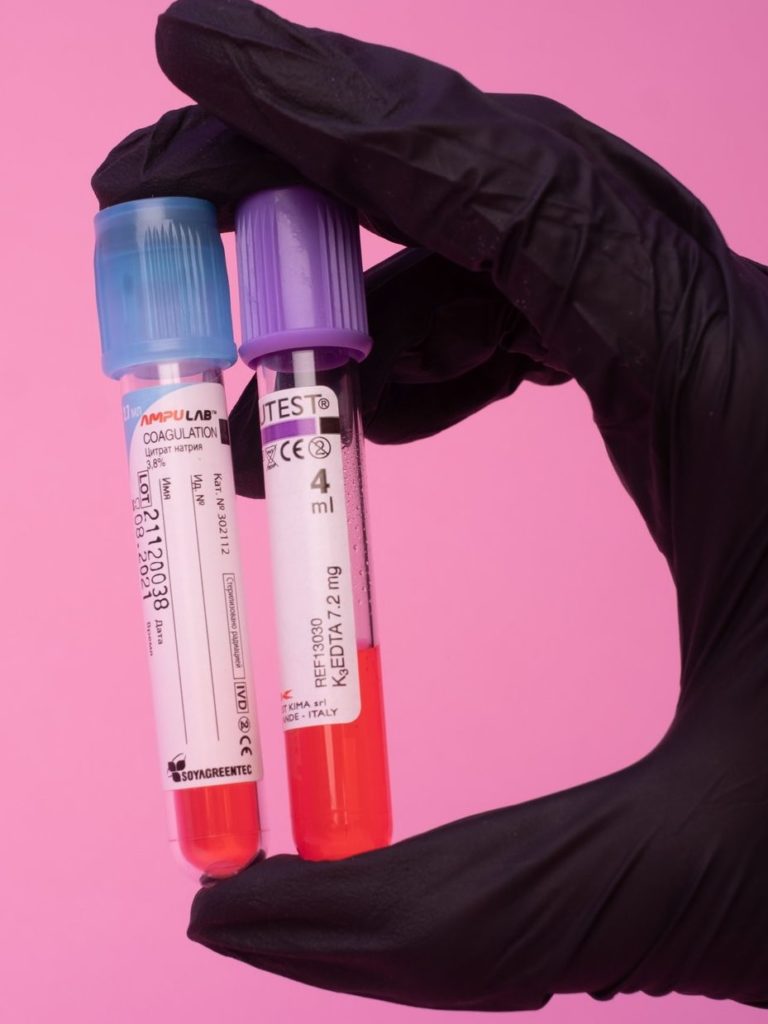 تحليل فيتامين د بالدم، الجرعة اليومية من فيتامين د