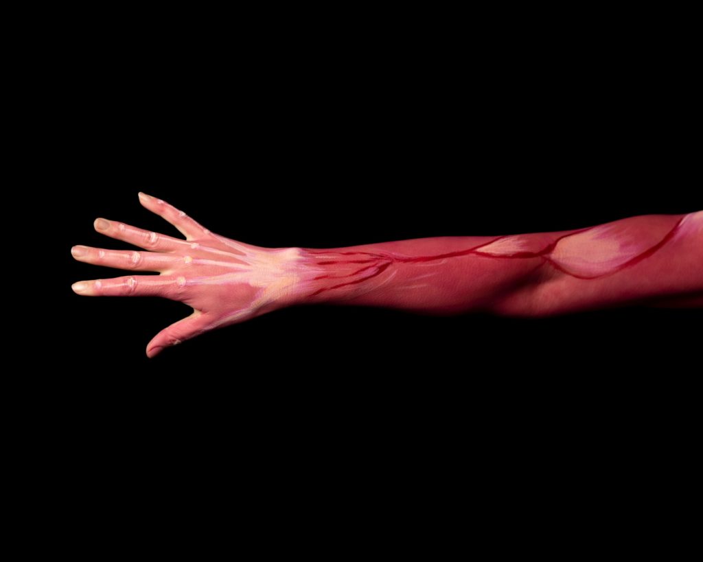 أضرار نقص البروتين